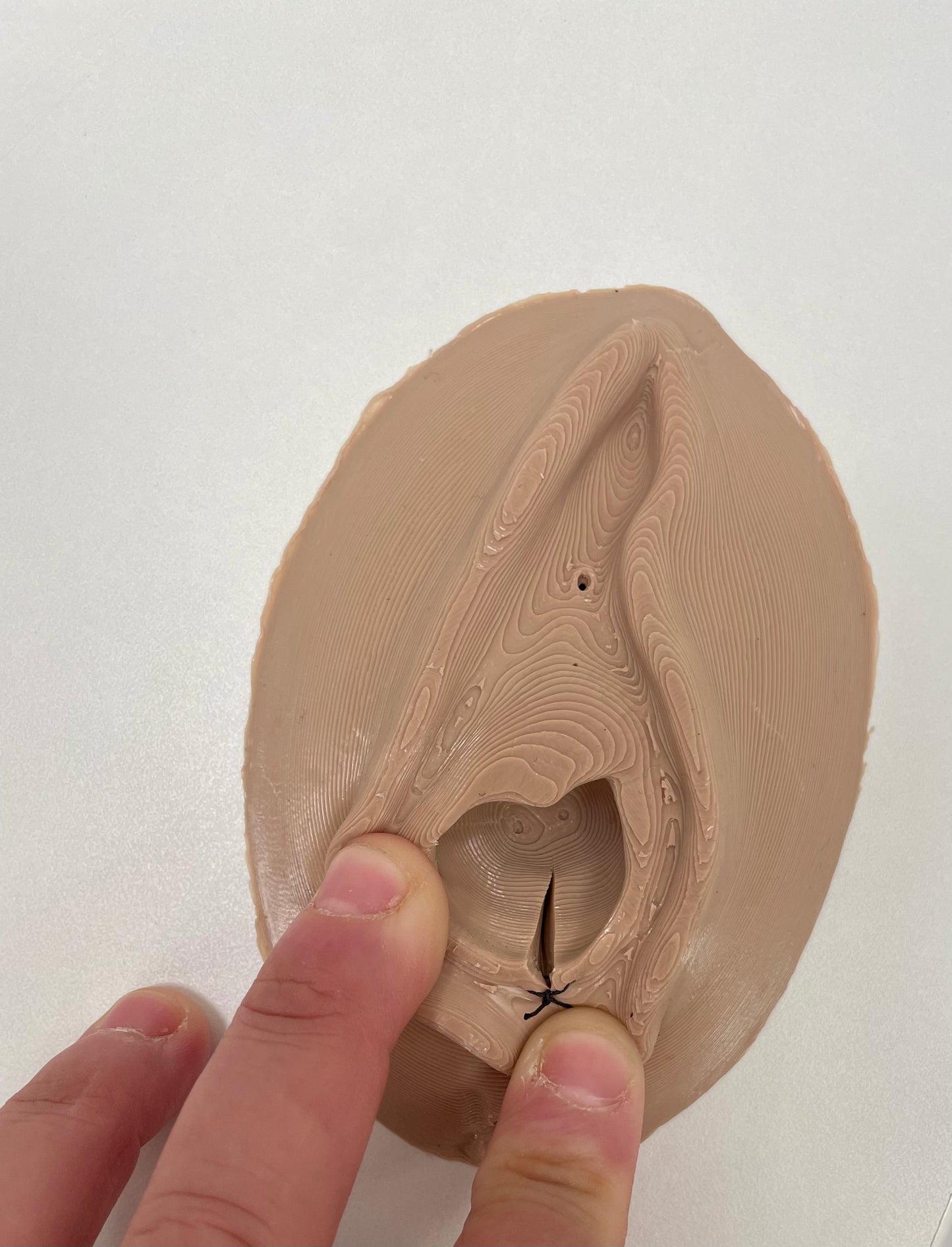 Vulva per Suture